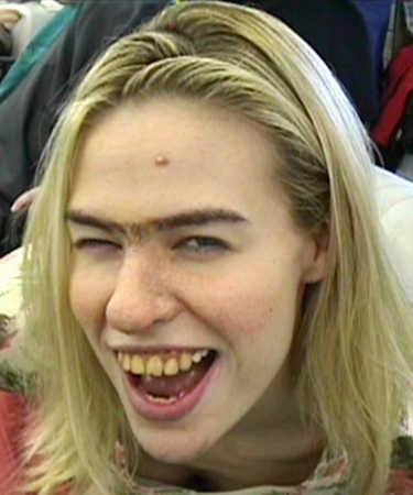 woman-with-unibro-spot-on-head-and-yellow-teeth-poor-boyfriend.jpg